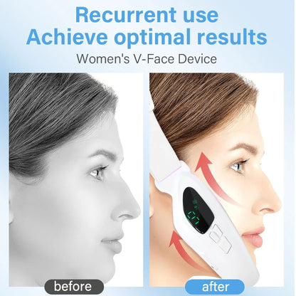 4 in 1 Electric Double Chin Remover V Line Face Slimming Massager Face Lift Device with Remote Controllor for Facial Contouring
